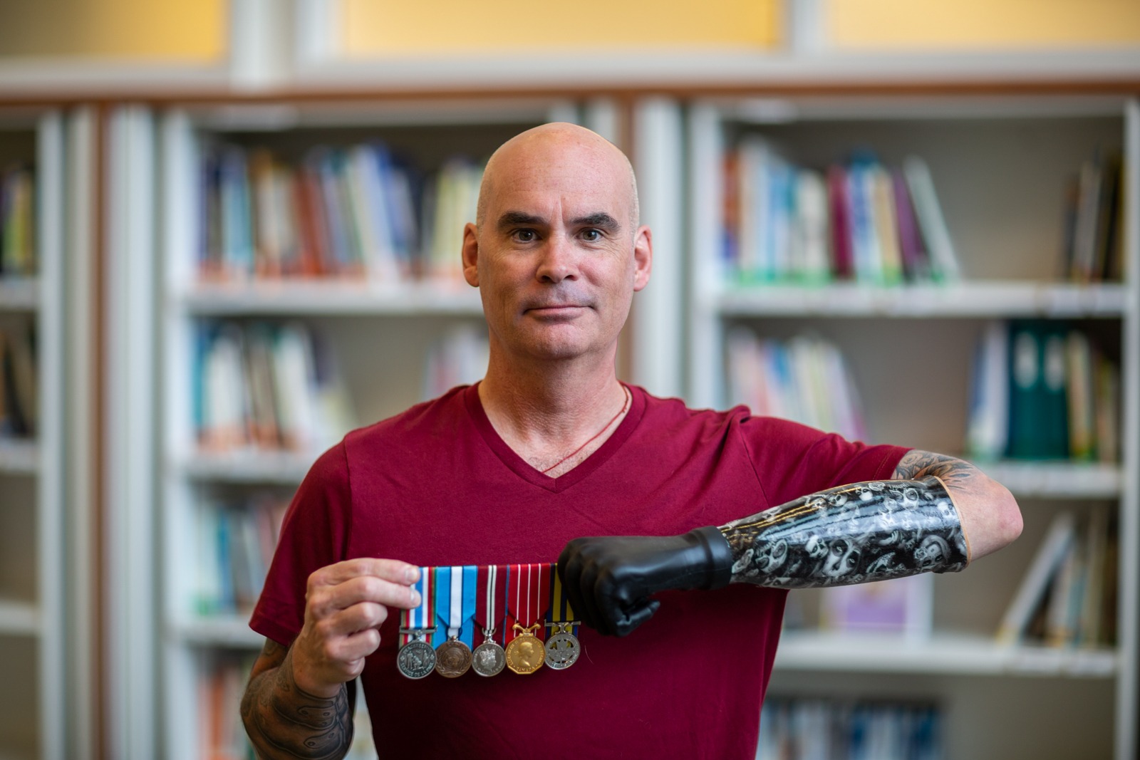 Craig holds his medals with his myoelectric hand 