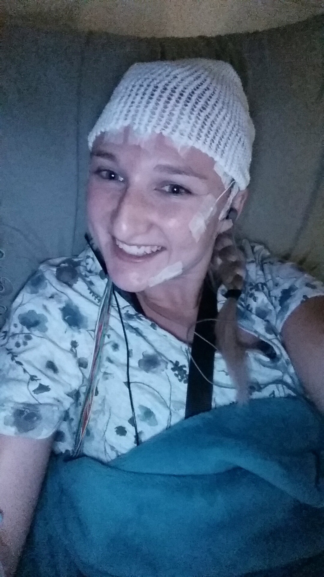 Katie is wearing a cap and wires in the epilepsy monitoring unit
