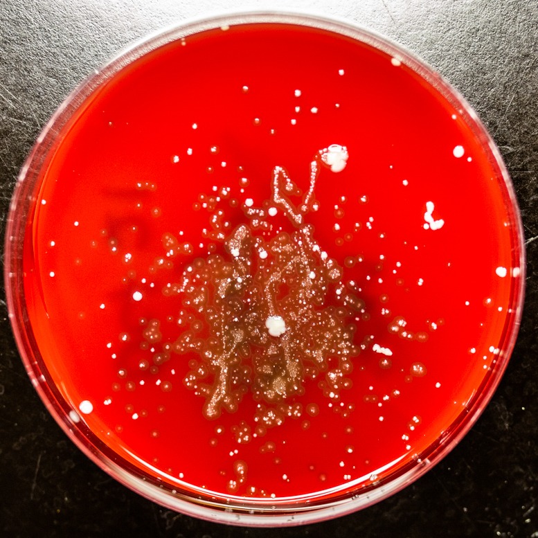 strands and flecks of bacteria growth on a petri dish