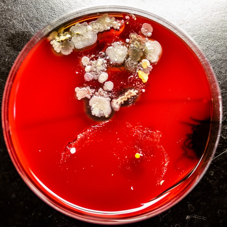 mouldy looking bacteria on a petri dish