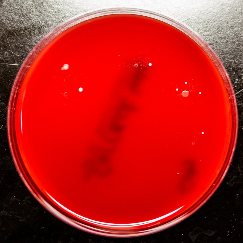 A petri dish with very few dots of bacteria on it