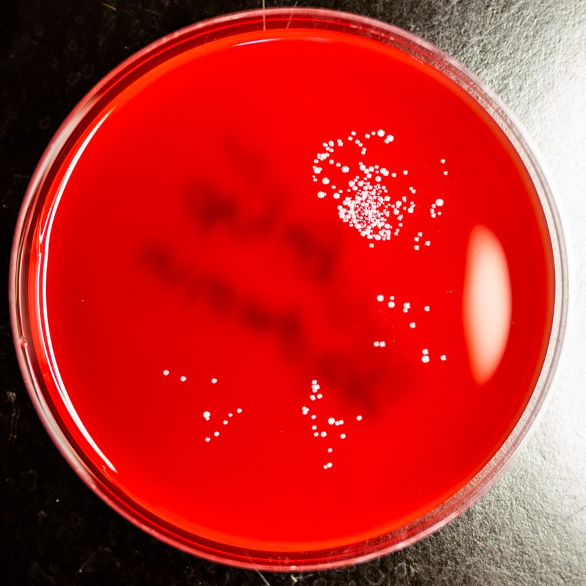 moderate bacteria growth in a petri dish