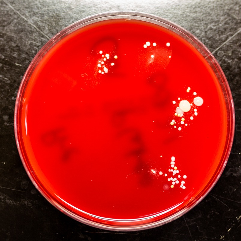 a petri dish with bacteria growing on fingerprints
