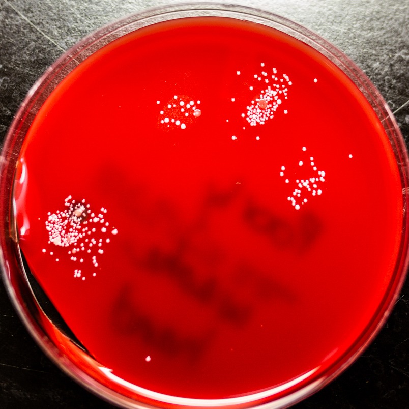 A petri dish with bacteria growth on fingerprints