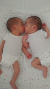 Mono Mono twins share a kiss after birth